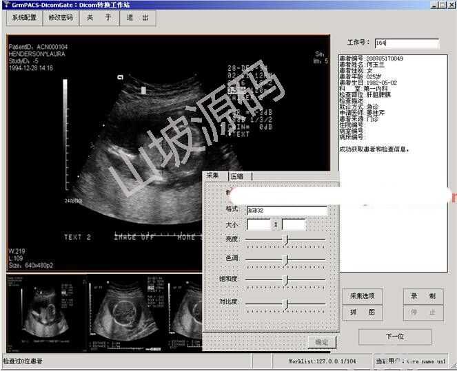 大型医院管理系统源码PACS超声科室源码DICOM工作站 C# CS架构