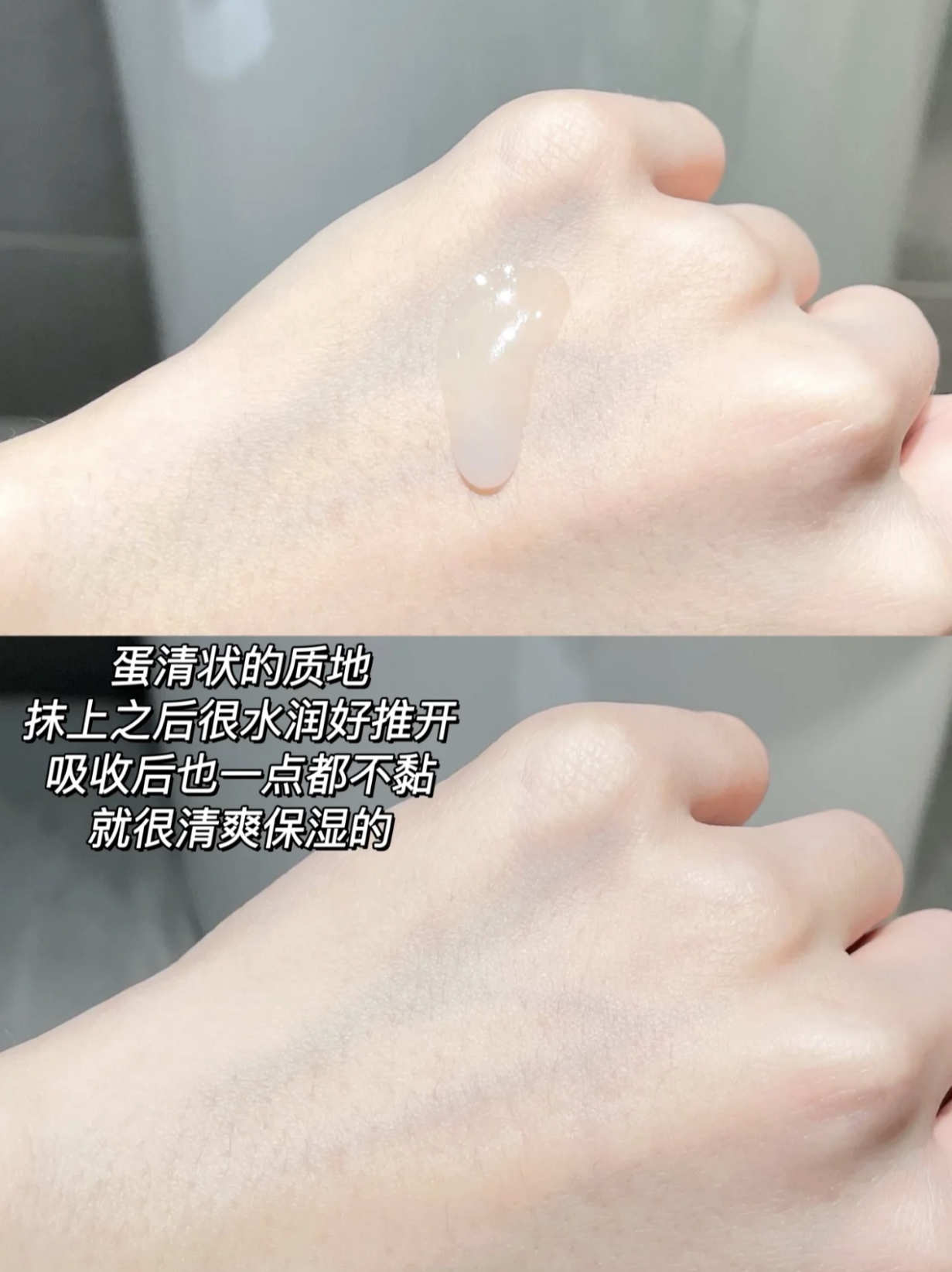 薇诺娜舒敏精华液保湿修护敏感肌修护屏障补水舒缓退红正品源码